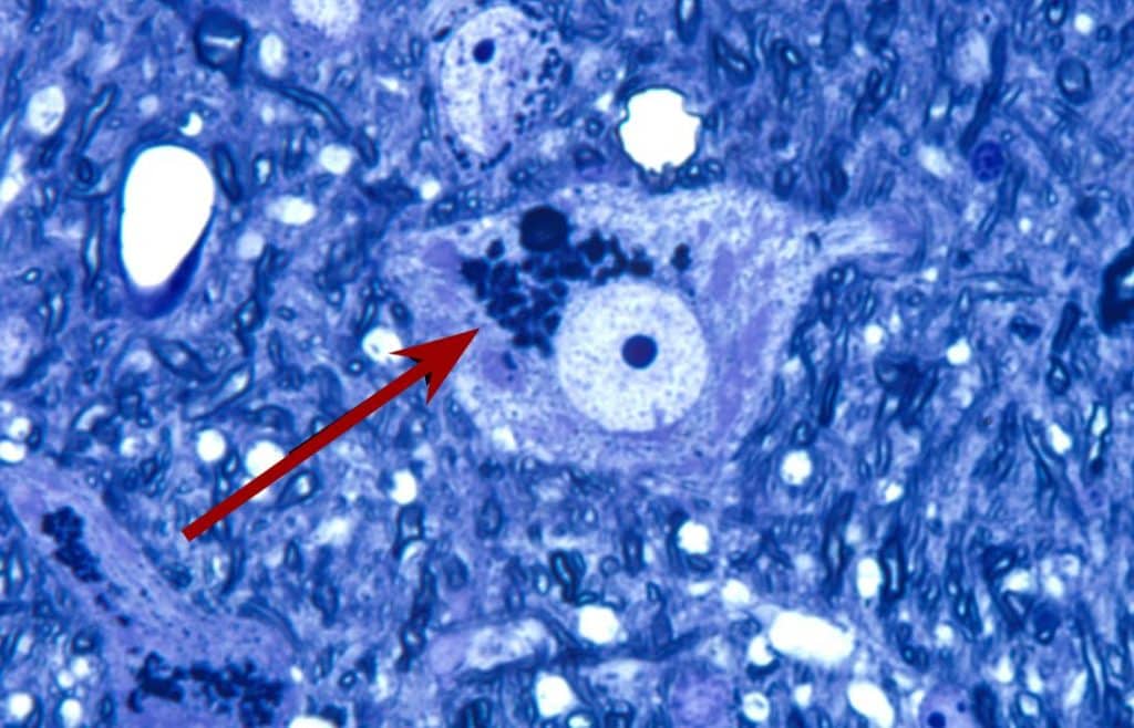 An accumulation of junk (lipofuscin granules) in a brain cell. Image Credit: Wikimedia